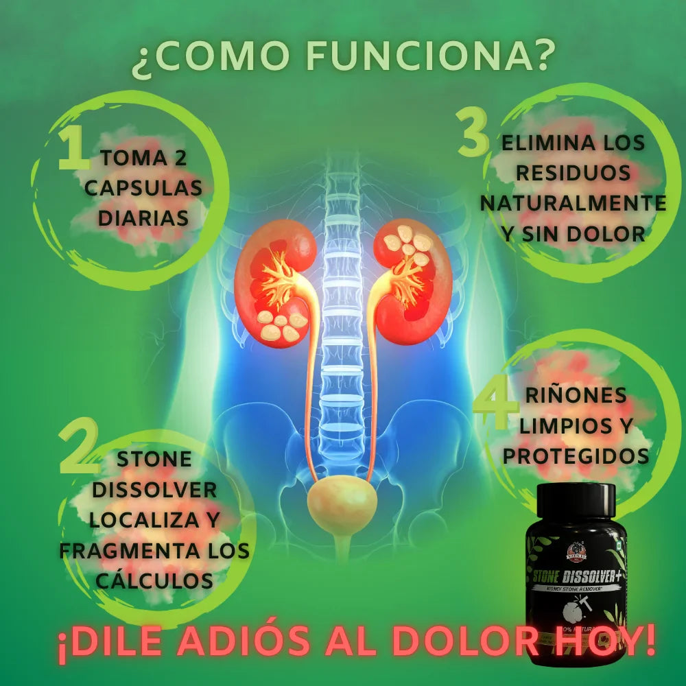 Stone Dissolver - Capsulas para expulsar y prevenir cálculos renales - OFERTA 2X1