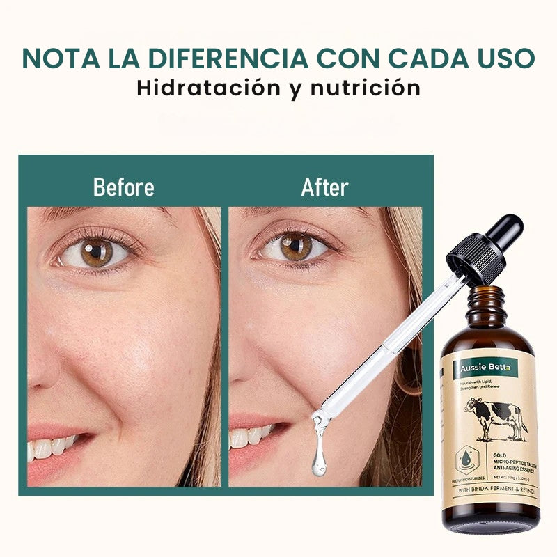 Aussie Betta - Suero de sebo con micropéptidos dorados - OFERTA 2X1