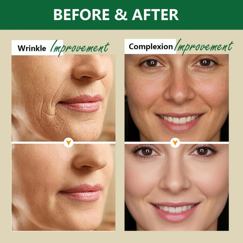 Aussie Betta - Suero de sebo con micropéptidos dorados - OFERTA 2X1