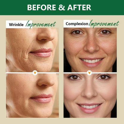 Aussie Betta - Suero de sebo con micropéptidos dorados - OFERTA 2X1