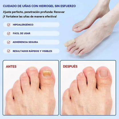21 Parches Antimicóticos Para La Salud De Las Uñas Y Los Pie